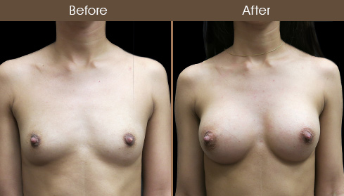 20202805155747_B84-Front